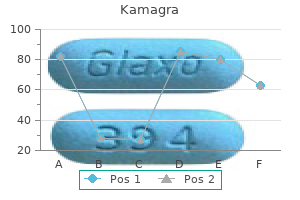 buy 100 mg kamagra