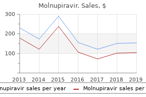 best purchase for molnupiravir