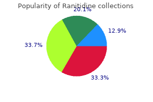 best 300mg ranitidine
