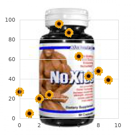 Beta ketothiolase deficiency